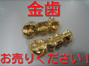 金歯お売りください