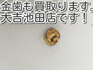 金歯の買取なら大吉池田店へ。